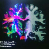 neuroradiology (The Human Brain)